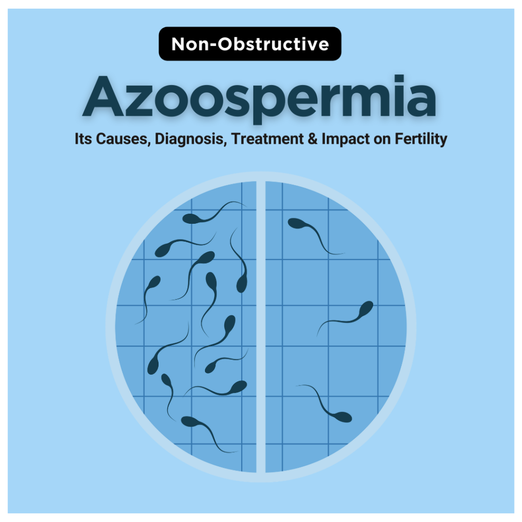 Non-Obstructive Azoospermia: Its Causes, Diagnosis, Treatment & Impact on Fertility